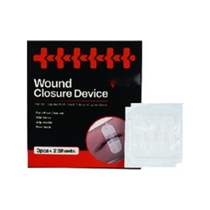 Stitch-Free Zip Wound Closure Strips